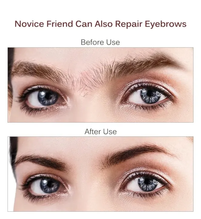 Electric-Facial-Hair-Remover-for-Women